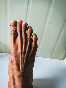 Close up foot Stock Photos