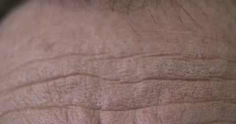 Close up of a forehead Stock Footage 84293910