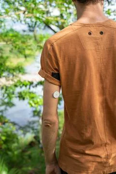 Close up Freestyle Libre 2 sensor on the arm of a young man standing outdoor 写真素材