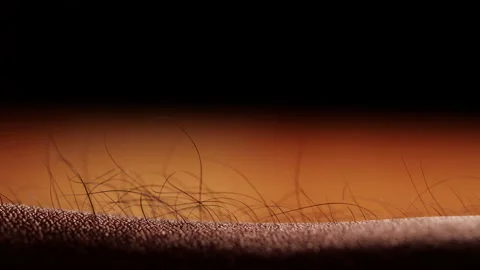 Close-up of getting goose bumps Stock Footage 135777207