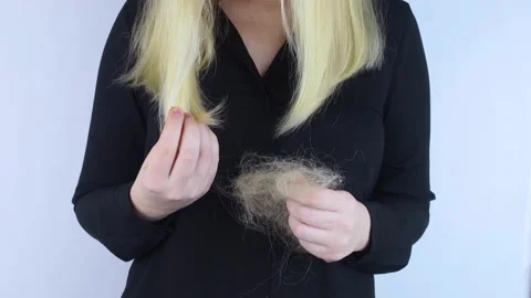 Close-up of a girl whose hair is falling out. There is a large tuft of tangled c Stock Footage 168687002