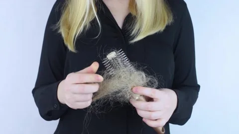 Close-up of a girl whose hair is falling out. There is a large tuft of tangled c Stock Footage 168687535