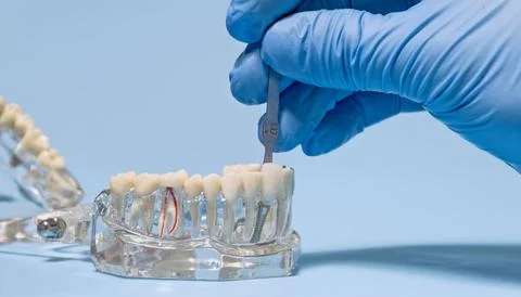 Close-up of a gloved hand using a dental shade guide to match the color of .. Stock Photos