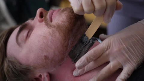 Close up hairy face man using wax epilation at beauty saloon. Stock Footage 149482580