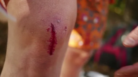 Close up of hand cleaning blood on the knee after bicycle crash in slow motion Stock Footage 44236301