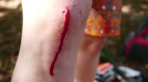 Close up of hand cleaning blood on the knee after bicycle crash in slow motion Stock Footage 44236376