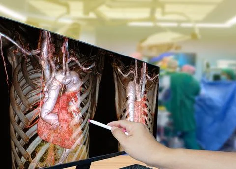 Close up hand Doctor point the computer monitor during heart operation . Stock Photos