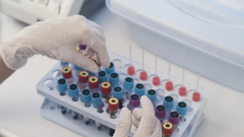 Close-up of the Hand in Glove Taking Test Tubes With Material for Laboratory Stock Footage 201459731