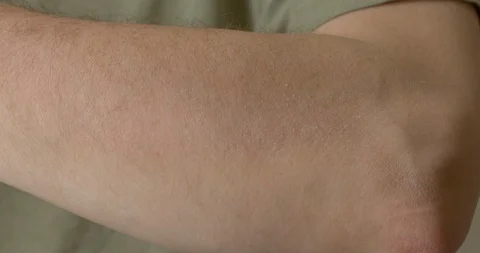 Close up of hand itching the back of person's arm 4K Stock Footage 119990428
