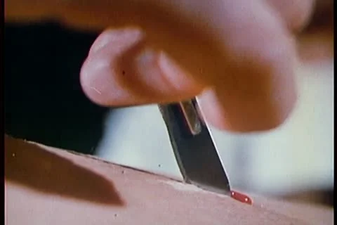 Close-up of hand with knife making incision in skin Stock Footage
