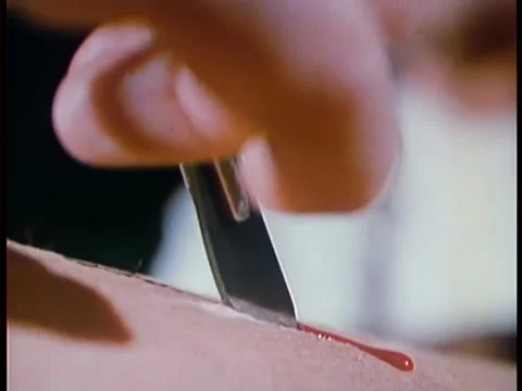 Close-up of hand with knife making incision in skin Stock Footage 260251755