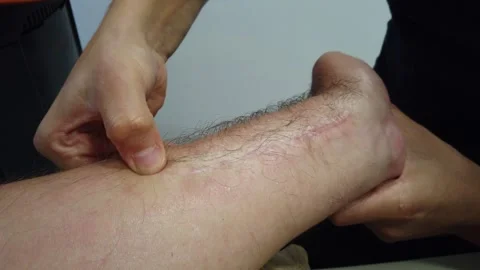 Close-up of hand physiotherapy treatment Stock-Footage 249745374