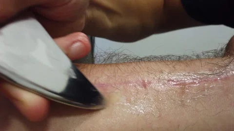 Close-up of hand physiotherapy treatment Stock Footage 249747428