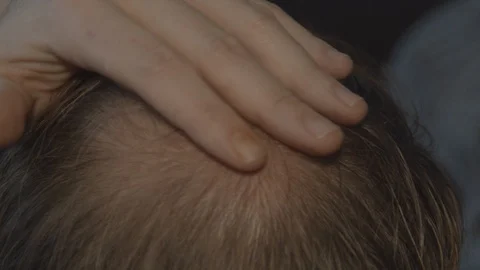Close up of hand rubbing bald spot on man's head Stock Footage 122085305