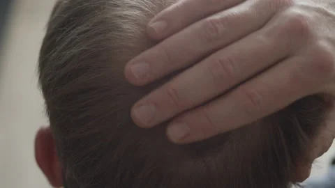 Close up of hand slowly rubbing man's bald spot on head Stock Footage 150190537