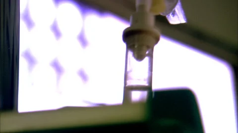 Close-up of hand touching an IV drip with MRI/CT image in background HD Video Vídeo Stock 61855070