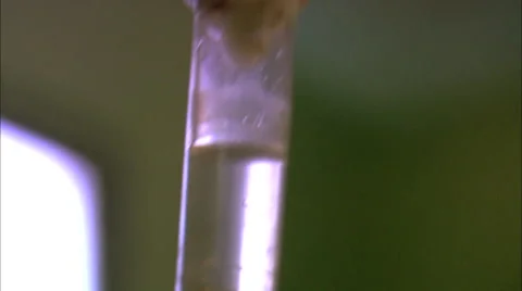 Close-up of hand touching an IV drip HD Video Vídeo Stock 61855107