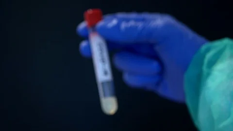 Close up of hand wearing nitrile gloves holding a sample tub with Coronavirus Stock Footage 127638909