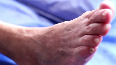 CLOSE UP-HANDHELD SHOT. Doctor's hands touching a patient leg during a check up. Stock Footage 48497423