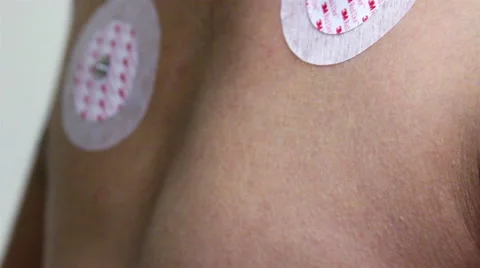 CLOSE UP-HANDHELD SHOT. Node wiress being conected in a man chest. Stock-Footage 45819260