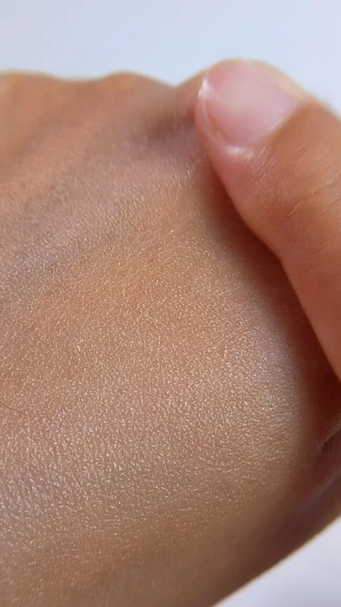 Close up of hands applying moisturizing lotion to treat dry skin and improv.. Stock Footage 338231433