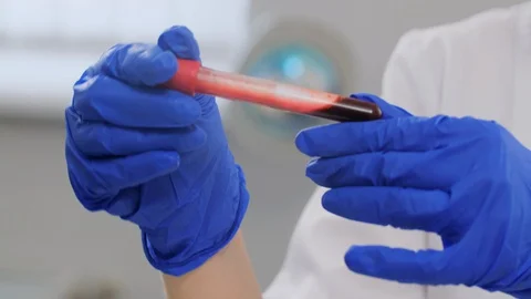 Close up hands with coronavirus blood test. 動画素材 128373755