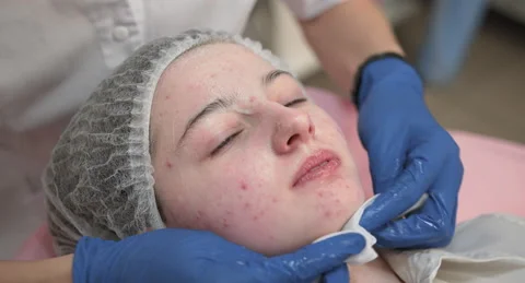 Close up of hands of cosmetologist in blue rubber gloves, applying professional Stock Footage 153407681