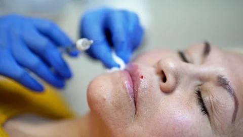 Close up of hands of cosmetologist making botox injection. She is holding Stock Footage 145695360
