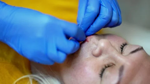 Close up of hands of cosmetologist making botox injection. She is holding Stock Footage 145695456