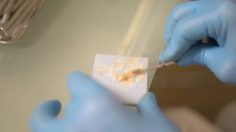 Close-Up,hands of a Dentist to Thoroughly Knead the Filling Material to the Root Stock Footage 76554750