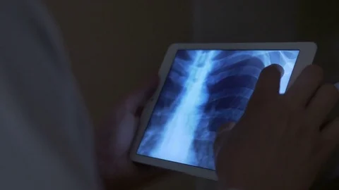 Close-up of hands of a doctor holding a tablet with an x-ray Stock Footage 75132345