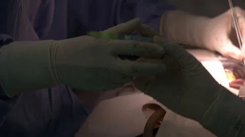 Close up hands of doctors operating in surgical room Stock Footage 129496400