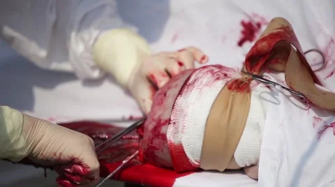 Close up of hands making surgery Stock Footage 64754736