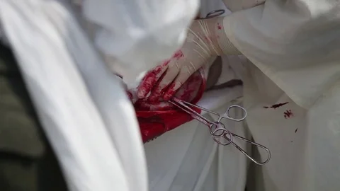 Close up of hands making surgery Stock-Footage 74546316