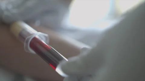 Close up of hands in medical gloves drawing blood. Stock Footage