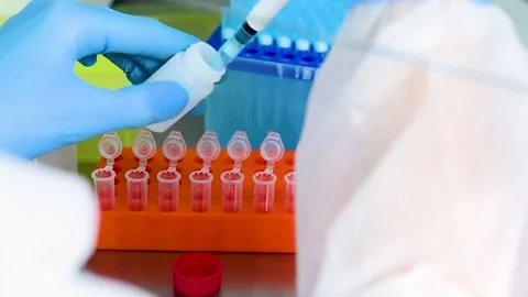 Close-up of the hands of a PCR lab worker in rubber gloves with a dispenser Stock Footage 149870606