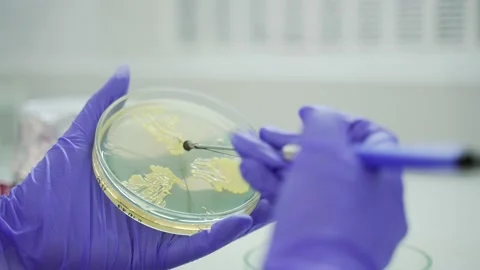 Close up hands of scientist working with different shaped colonies of bacteria  Stock Footage 233309724