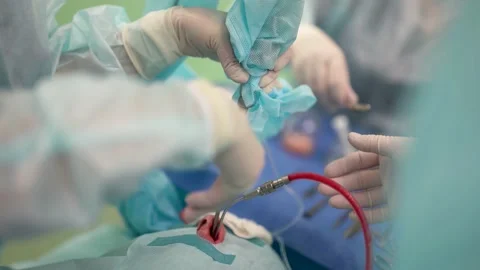 Close-up of the hands of specialists at work in the operating room. Modern Видео 179312274
