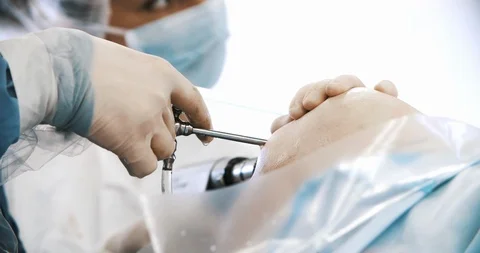 Close up of hands of surgeons team during operation on knee with surgical Stock Footage 121098226
