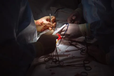 Close-up hands, team of doctors during surgery, surgical instruments on a Stock Photos