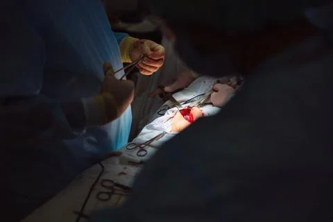 Close-up hands, team of doctors during surgery, surgical instruments on a table Stock Photos