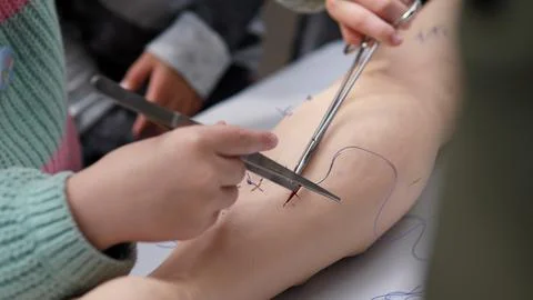 Close up hands using scissors and forceps on marked forearm during surgical 库存照片