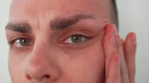 Close up head shot mirror reflection young caucasian man annoyed with dry Stock Footage 241746667