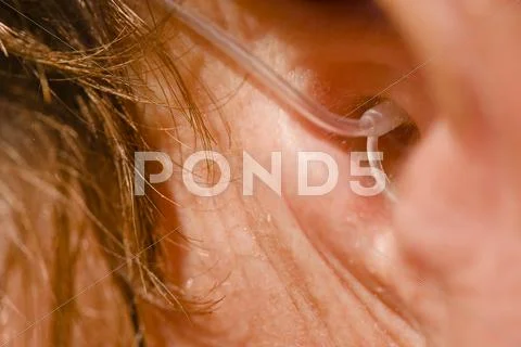 Close-Up Of Hearing Aid On The Woman's Ear