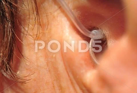Close-Up Of Hearing Aid On The Woman's Ear