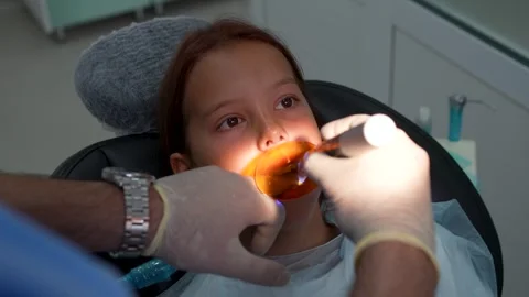 Close up high angle shot of a dentist using a dental UV curing light tool w.. Vídeo Stock 339076942