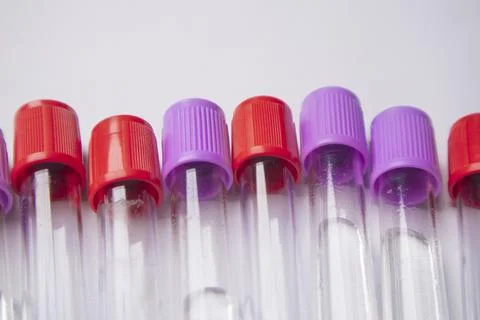 Close-up, high-angle shot of several empty medical blood collection tubes w.. Stock Photos