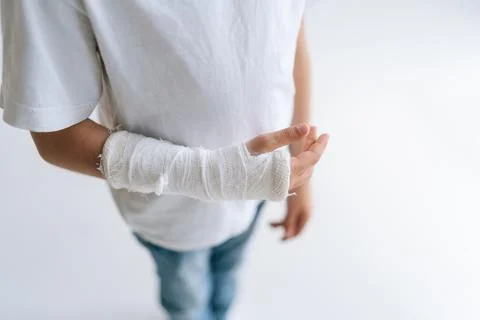 Close-up high-angle view of unrecognizable little girl with broken hand wrapped Stock Photos