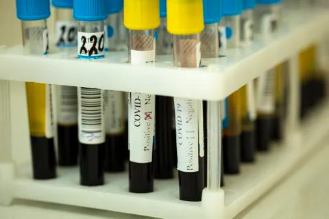 Close up holder with tubes of biological samples, positive covid-19 test result Foto stock