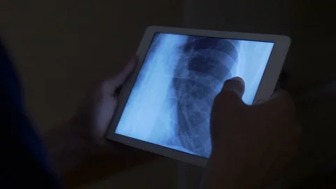 Close-up of holding a tablet with an x-ray Stock Footage 75132285